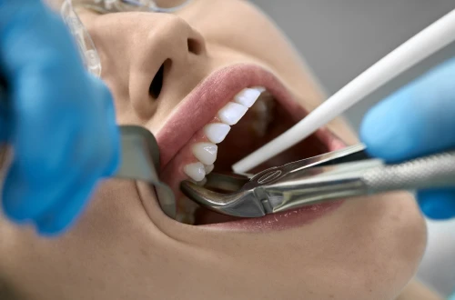 Extraction-implantation immédiate